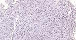 Histone H3 (di methyl K27) Antibody in Immunohistochemistry (Paraffin) (IHC (P))