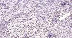 Histone H3 (di methyl K27) Antibody in Immunohistochemistry (Paraffin) (IHC (P))