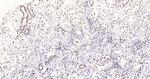 Histone H3 (di methyl K27) Antibody in Immunohistochemistry (Paraffin) (IHC (P))