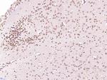 Histone H3 (di methyl K79) Antibody in Immunohistochemistry (Paraffin) (IHC (P))