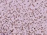 Histone H3 (di methyl K79) Antibody in Immunohistochemistry (Paraffin) (IHC (P))