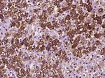 Caspase 3 Antibody in Immunohistochemistry (Paraffin) (IHC (P))