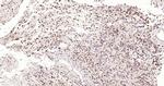 P53 Antibody in Immunohistochemistry (Paraffin) (IHC (P))