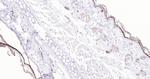 P53 Antibody in Immunohistochemistry (Paraffin) (IHC (P))