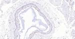 P53 Antibody in Immunohistochemistry (Paraffin) (IHC (P))