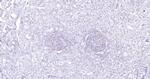 P53 Antibody in Immunohistochemistry (Paraffin) (IHC (P))