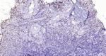 P53 Antibody in Immunohistochemistry (Paraffin) (IHC (P))