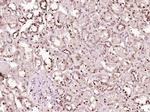 P53 Antibody in Immunohistochemistry (Paraffin) (IHC (P))