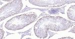 P53 Antibody in Immunohistochemistry (Paraffin) (IHC (P))