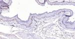 P53 Antibody in Immunohistochemistry (Paraffin) (IHC (P))