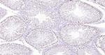 P53 Antibody in Immunohistochemistry (Paraffin) (IHC (P))