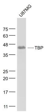 TATA binding protein TBP/TBP Antibody in Western Blot (WB)