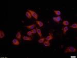 Bax Antibody in Immunocytochemistry (ICC/IF)