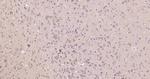 GSK-3 Beta Antibody in Immunohistochemistry (Paraffin) (IHC (P))