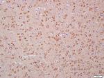 LC3A Antibody in Immunohistochemistry (Paraffin) (IHC (P))