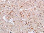 LC3A Antibody in Immunohistochemistry (Paraffin) (IHC (P))