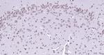 Lamin A/C Antibody in Immunohistochemistry (Paraffin) (IHC (P))