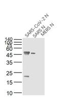 SARS Nucleocapsid Protein Antibody in Western Blot (WB)