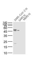 SARS Nucleocapsid Protein Antibody in Western Blot (WB)