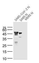 SARS Nucleocapsid Protein Antibody in Western Blot (WB)