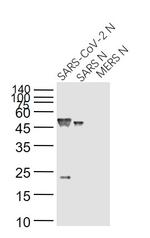 SARS Nucleocapsid Protein Antibody in Western Blot (WB)