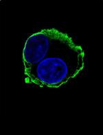 MMP14 Antibody in Immunocytochemistry (ICC/IF)