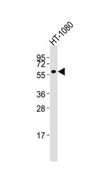 MMP14 Antibody in Western Blot (WB)