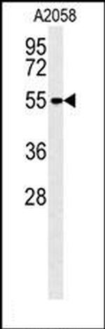 MMP14 Antibody in Western Blot (WB)