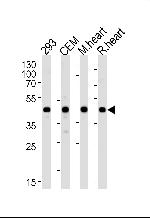 VEGFC Antibody in Western Blot (WB)