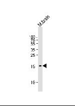 GABARAP Antibody in Western Blot (WB)