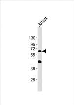 CYP1A1 Antibody in Western Blot (WB)