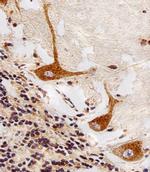 PPT1 Antibody in Immunohistochemistry (Paraffin) (IHC (P))