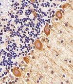 PPT1 Antibody in Immunohistochemistry (Paraffin) (IHC (P))