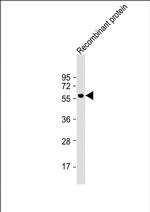 KLF4 Antibody in Western Blot (WB)