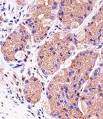 PINK1 Antibody in Immunohistochemistry (Paraffin) (IHC (P))