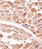 PINK1 Antibody in Immunohistochemistry (Paraffin) (IHC (P))