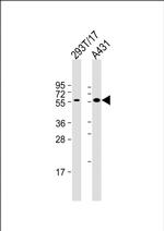 PINK1 Antibody in Western Blot (WB)