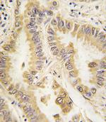 SOD2 Antibody in Immunohistochemistry (Paraffin) (IHC (P))