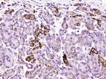 SOD2 Antibody in Immunohistochemistry (Paraffin) (IHC (P))