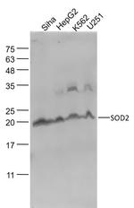 SOD2 Antibody in Western Blot (WB)