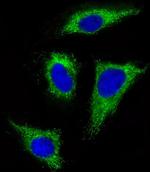 FGFR1 Antibody in Immunocytochemistry (ICC/IF)