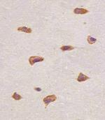 FGFR1 Antibody in Immunohistochemistry (Paraffin) (IHC (P))