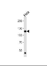 FGFR1 Antibody in Western Blot (WB)