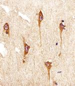 NTRK2 Antibody in Immunohistochemistry (Paraffin) (IHC (P))