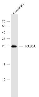 RAB3A Antibody in Western Blot (WB)