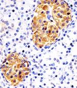 RAB3B Antibody in Immunohistochemistry (Paraffin) (IHC (P))