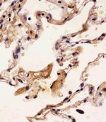 S100A2 Antibody in Immunohistochemistry (Paraffin) (IHC (P))