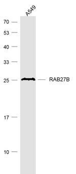 RAB27B Antibody in Western Blot (WB)