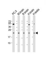 RAB18 Antibody in Western Blot (WB)