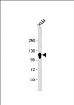 CYLD Antibody in Western Blot (WB)